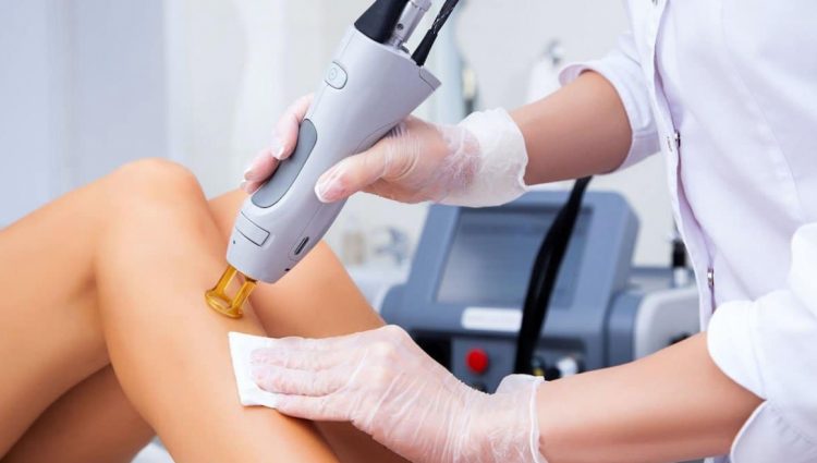 Top-Notch Reasons For Undergoing The Laser Hair Removal Procedure